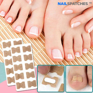 Parches mata hongos I OFERTA 3x1🎁Adiós a las uñas encarnadas!! NailsPatches